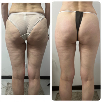 Ксения Масажист, Борисполь Фото - 3