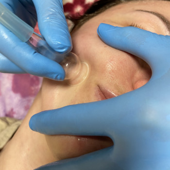 Віра Галева, Одеса Фото - 6