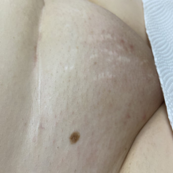 Віра Галева, Одеса Фото - 7