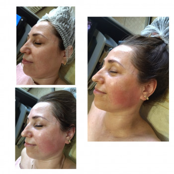 Анна Юрьєва, Одеса Фото - 27