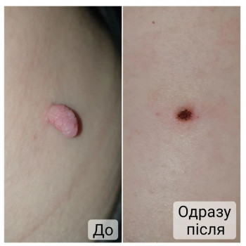 Ганна Філоненко, Кременчук Фото - 15