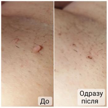 Ганна Філоненко, Кременчук Фото - 11