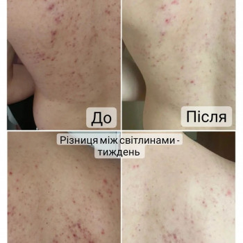 Ганна Філоненко, Кременчук Фото - 7