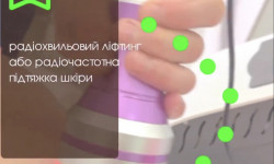 RF ліфтинг Массажист Олена Запорожье