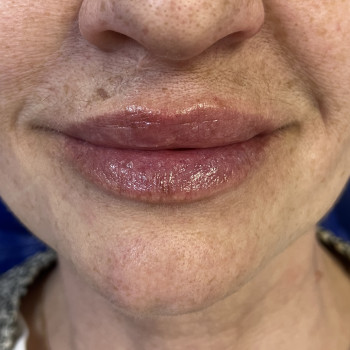 Катерина Наумець, Киев Фото - 6