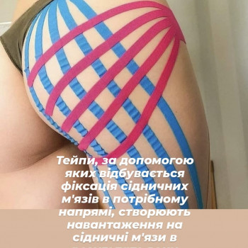 Кінозіотейпування
                    Косметолог-эстетист Тетяна Мукачево