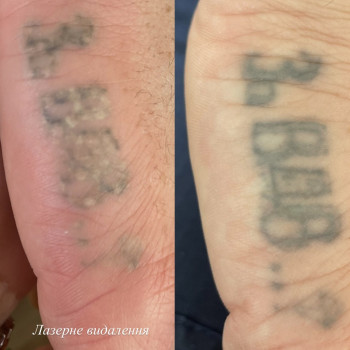 Алёна Савченко, Днепр Фото - 9