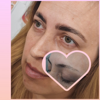 Альона Малярчук, Буча Фото - 5