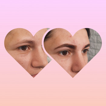 Альона Малярчук, Буча Фото - 6