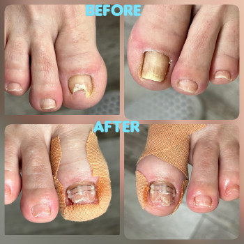   нігтів
  ногтей
 
  ніготь
  ноготь
 
 