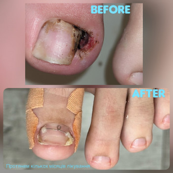   ніготь
  ноготь
 
 