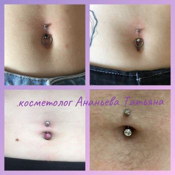 Пирсинг пупка