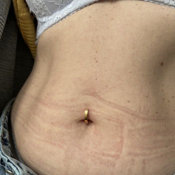 Юлия Ковалёва, Кропивницкий Фото - 39