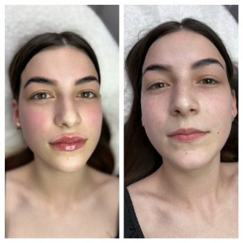 Юлия Ковалёва, Кропивницкий Фото - 46