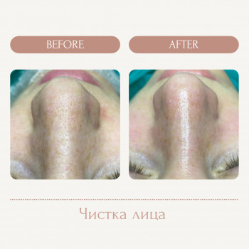 Елена Ласка, Запорожье Фото - 9