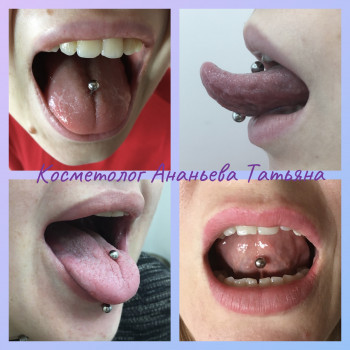 Пірсинг язика