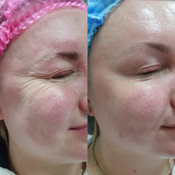 Оксана Ольшанська, Ізюм Фото - 5