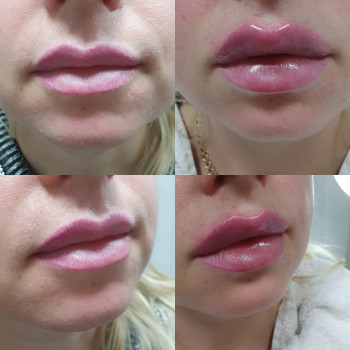 Оксана Ольшанська, Ізюм Фото - 7