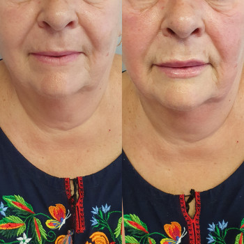 Оксана Ольшанська, Ізюм Фото - 10