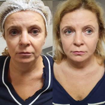 Оксана Ольшанська, Ізюм Фото - 13