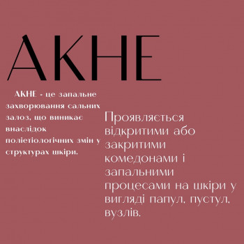 Лікування акне
                    Дерматолог косметолог Марта Львів