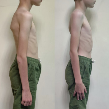 Анна Доброва, Одесса Фото - 6