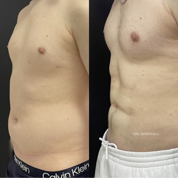 Абдель Эрритали, Київ Фото - 59