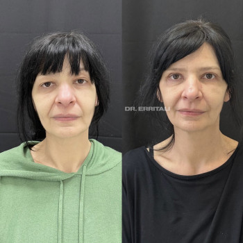 Абдель Эрритали, Київ Фото - 60