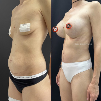 Абдель Эрритали, Київ Фото - 39