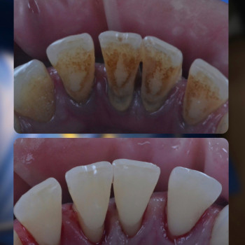 Аліна Степанюк, Рівне Фото - 37