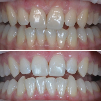 Аліна Степанюк, Рівне Фото - 39