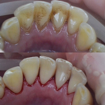 Аліна Степанюк, Рівне Фото - 40