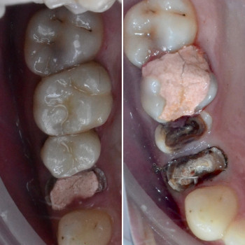 Аліна Степанюк, Рівне Фото - 41