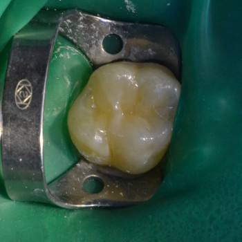 Аліна Степанюк, Рівне Фото - 44