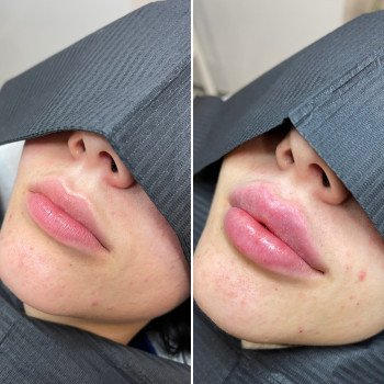 Любов Менн, Бердичів Фото - 3