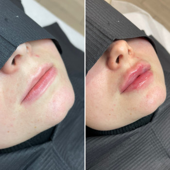 Любов Менн, Бердичів Фото - 4