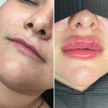 Любов Менн, Бердичів Фото - 5