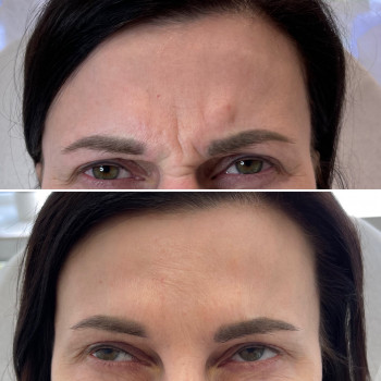 Любов Менн, Бердичів Фото - 6