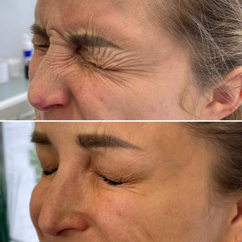 Любов Менн, Бердичів Фото - 15