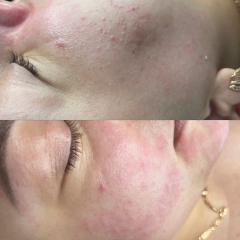 Карина Начвай, Житомир Фото - 3