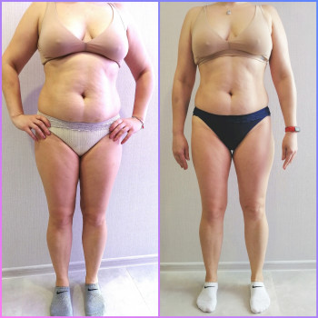 Вакуумно-роликовий масаж
                    Массажист Виктория Ирпень