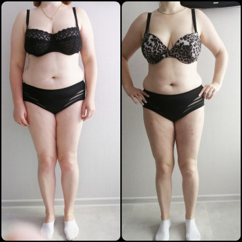 Вакуумно-роликовий масаж
                    Массажист Виктория Ирпень