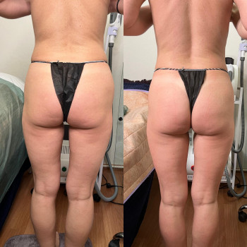 Оксана Древіна, Запорожье Фото - 9