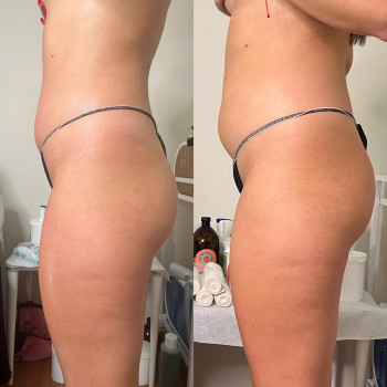 Оксана Древіна, Запорожье Фото - 15