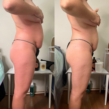 Оксана Древіна, Запорожье Фото - 16