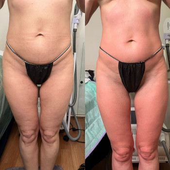 Оксана Древіна, Запорожье Фото - 25