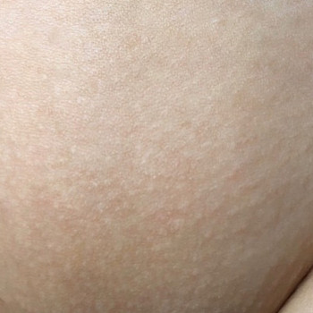 P.S. Clinic, Киев Фото - 10