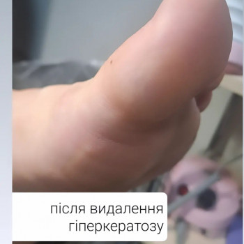 Ярина Кошик, Вишневе Фото - 36