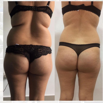 Вікторія Доценко, Кривий Ріг Фото - 30