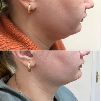 Вікторія Доценко, Кривий Ріг Фото - 7